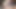 Deep Anal Masturbation Big Gaping Hot Anal Prolapse