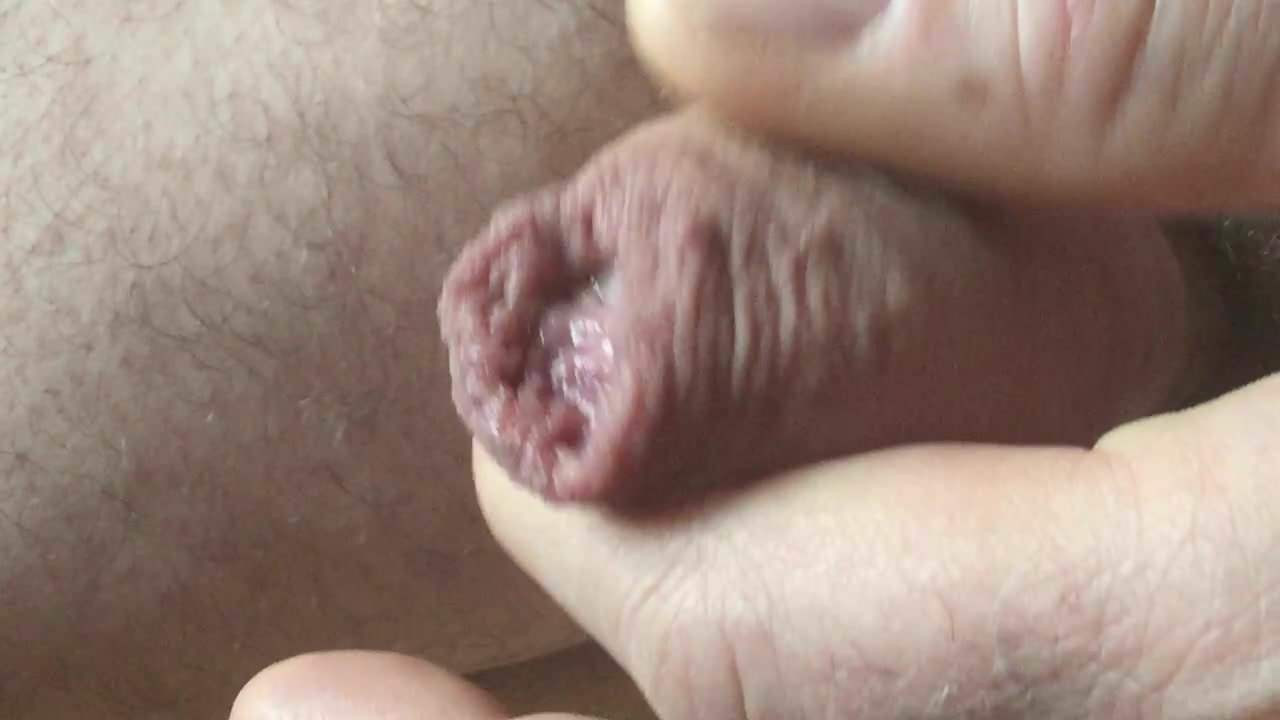 Foreskin 3