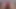 Dirtygardengirl in Silver Dress Take Big Bottle in Ass & Anal Prolapse
