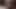 ブラックティーンベイブのスティップ フォー