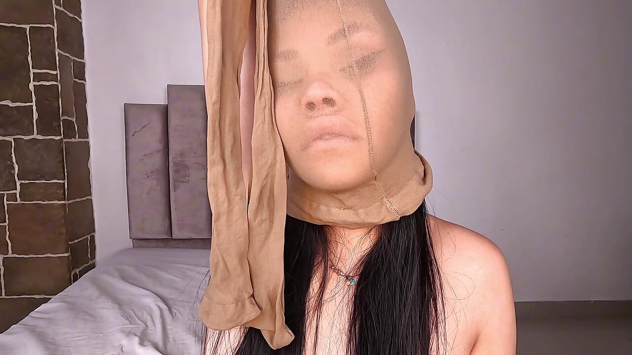 普通毁容的我