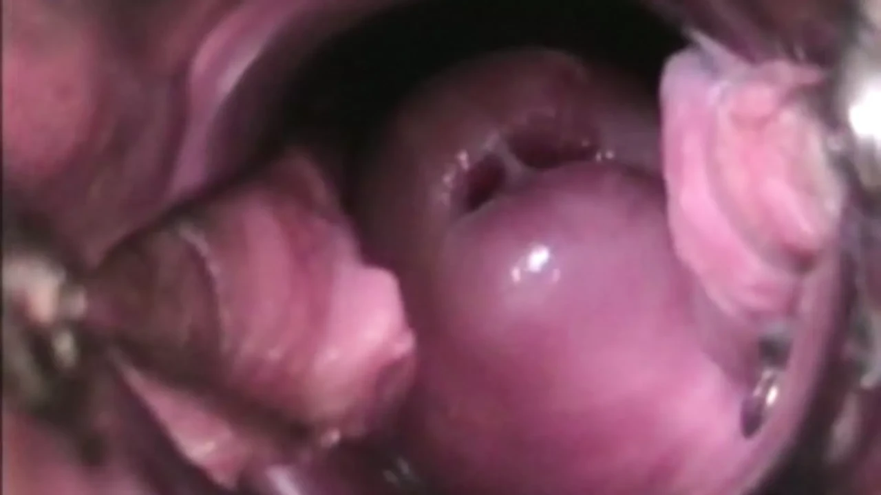CERVIKAL ORGASM IN DETAIL