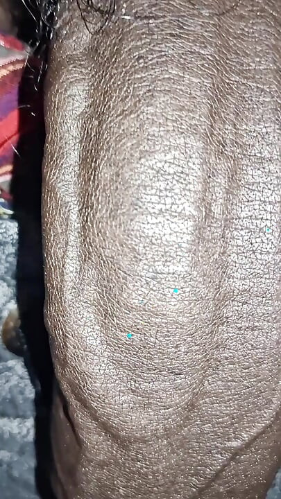 Close up on These Thick Veins