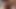 Megaculona Teasing