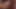 SkinVision