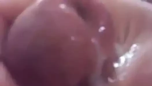 Grossebite
