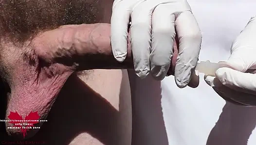 Медицинская стимуляция пениса