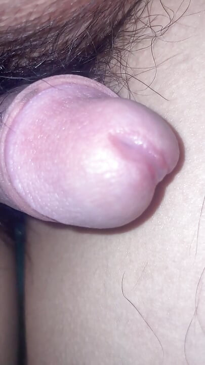 按摩前列腺和尿道球泡液。