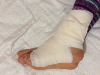 Bandage Füße meiner Frau
