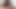 LizzyYum december 30 2023 Post Op Orgasm Pussy Masturbation Teasing