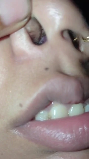 Spectacular moment from "Nose pulling Twisting pinching, Requested video Funny video"