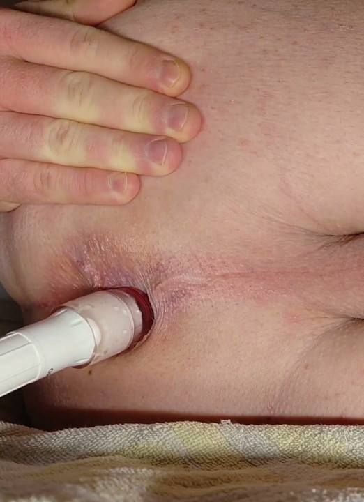 Anal vibrator