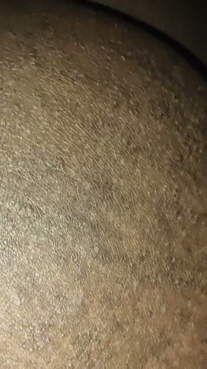 foreskin play | Clip 1