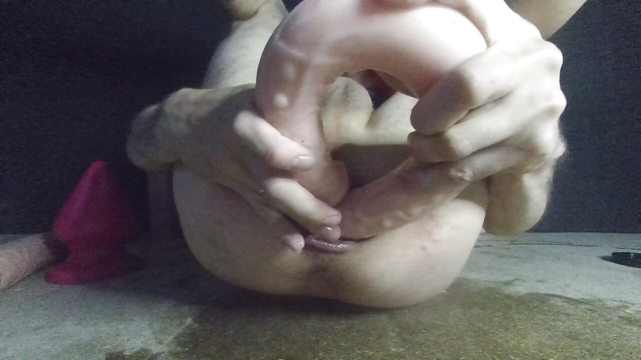 Anal prolapse