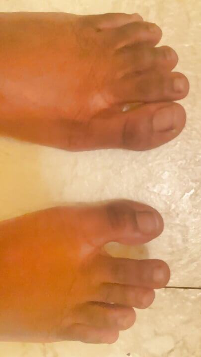 Can I Put These Toes In Your Mouth , Yes Or No ???????