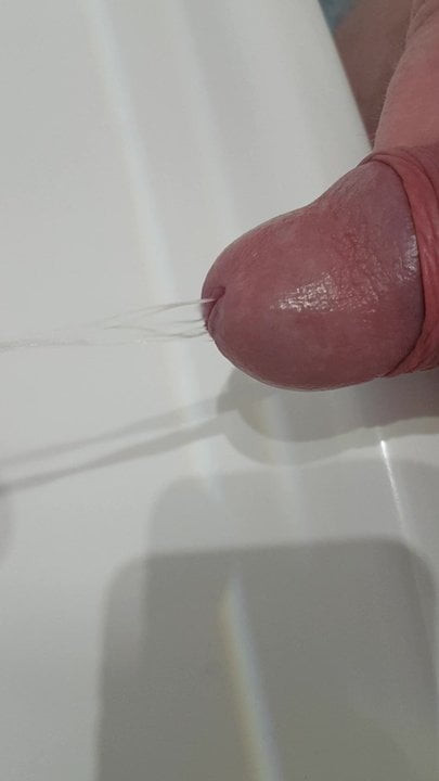 Pissen und spritzen