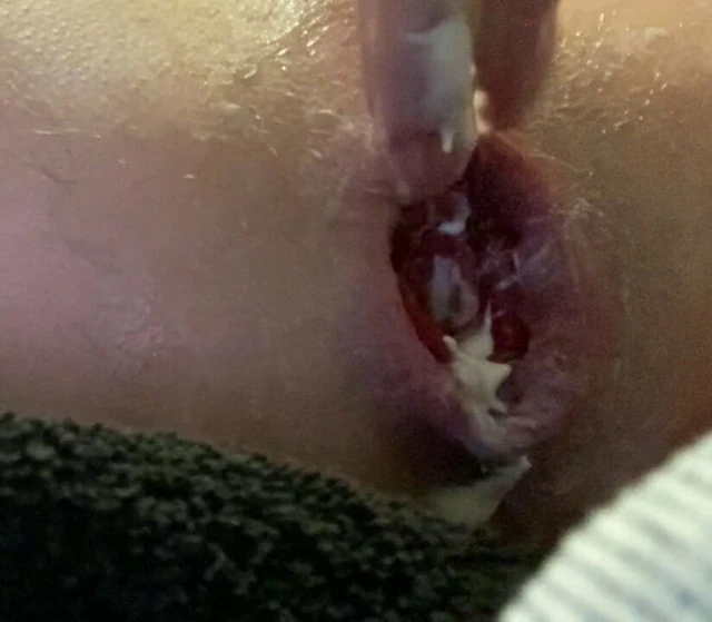 DOM Anal Fisting