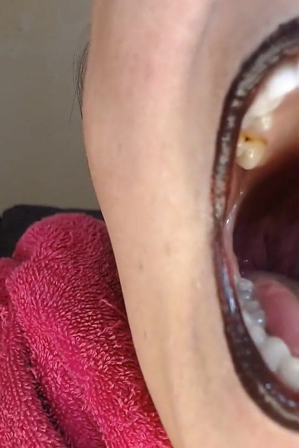 Big Wide Open Yawning