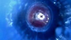 Einführkamera Endoskop tige Stamm Schwanz Ejac Sperma nach innen