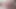 Hyperspermia 1