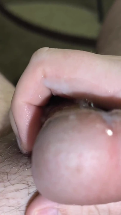 After snow and frost, I warm up with hot water and rubbing | Clip 2
