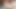 Deep Anal Masturbation Big Gaping Hot Anal Prolapse