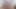 Lizzy Yum SD August 2025 Dilating #10