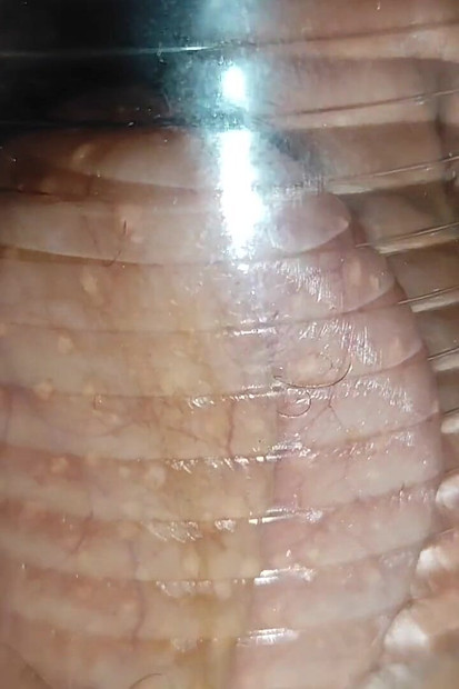 Тато досягає надзвичайного тиску на загрожений член