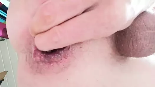 anal