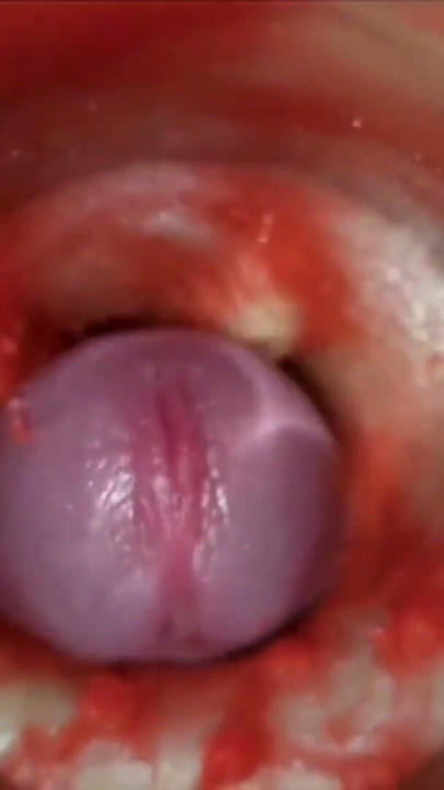 Cumfeti Dripping Creampie Compilation- Endoscopy view | Clip 1