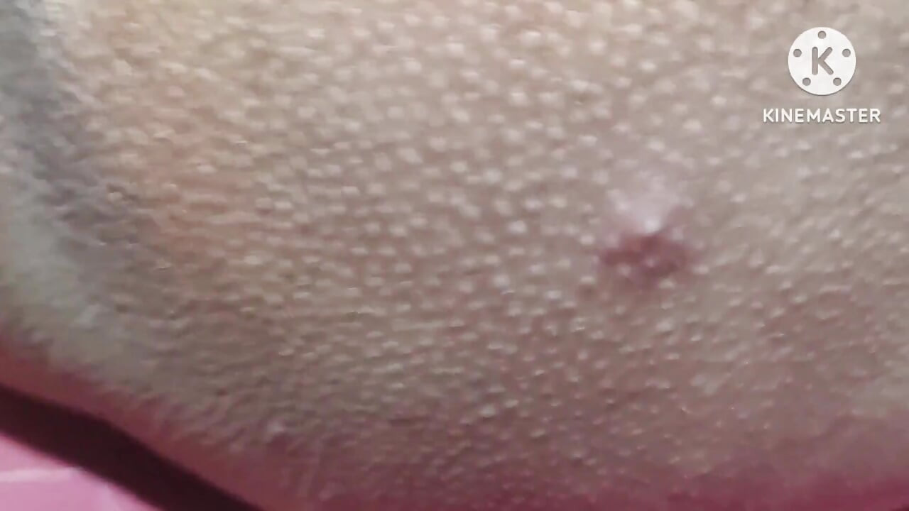 Fat Boobs