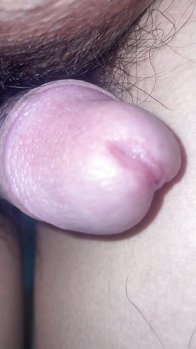 Massage the prostate and urethral bulb fluid.