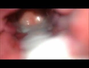 icine bosal