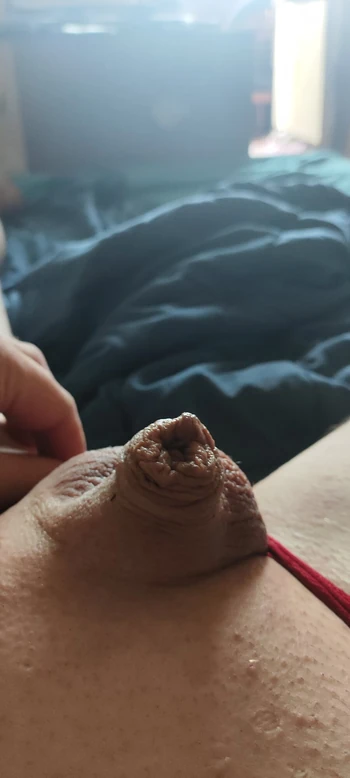 Small penis