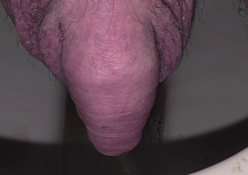 Peeing again