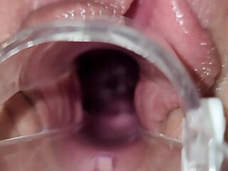 Speculum cervix orgasm cumshot