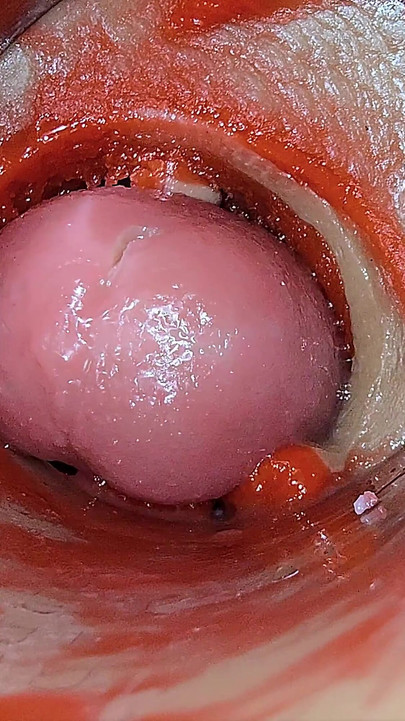 Kamera Unutar Duboke Pičke Snima Predoziranje Ejakulacija Sperme Asmr