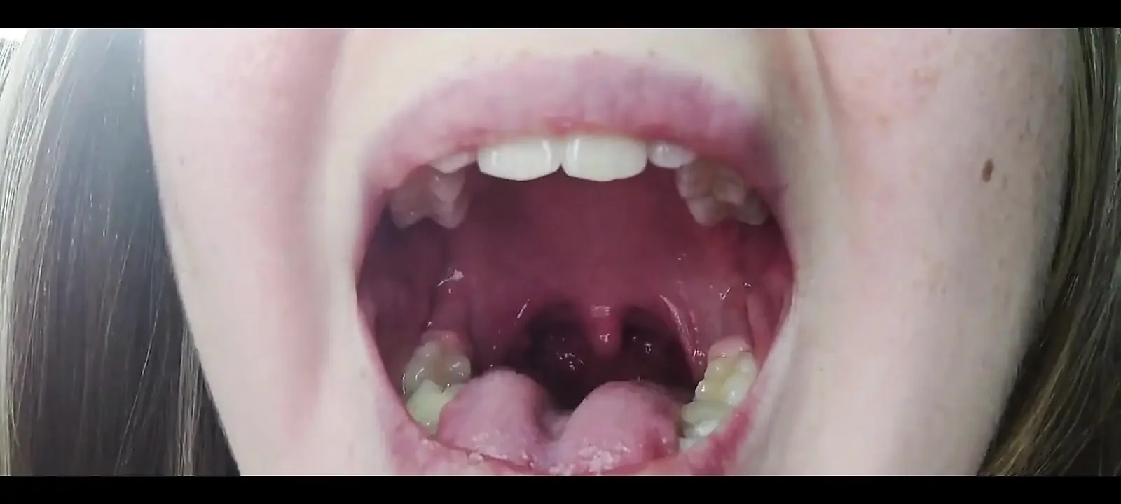 Throat Fetish