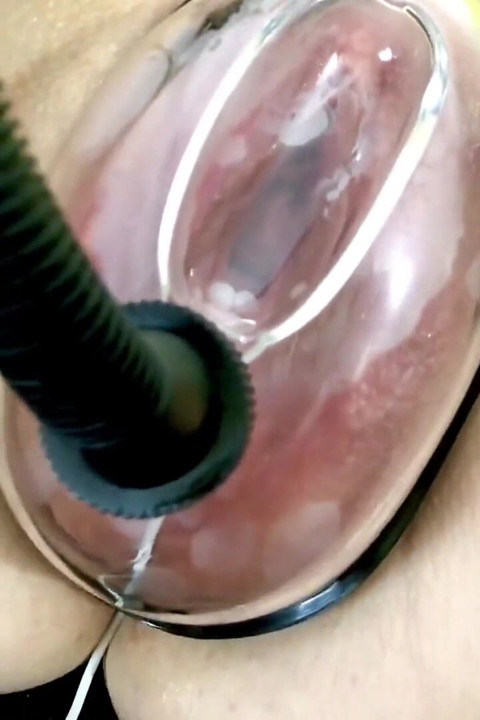 Vaginal Deformation Under the Influence of a Vacuum Pump