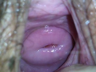 Un col uterin frumos