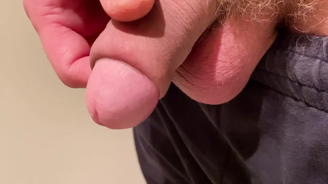Foreskin