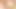 30 Fr catheter in tiny bi mtf cock