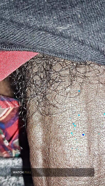 Close up on These Thick Veins