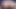 If You Like Butthole and Pussy Spreading Accidental Queefing This One's for You