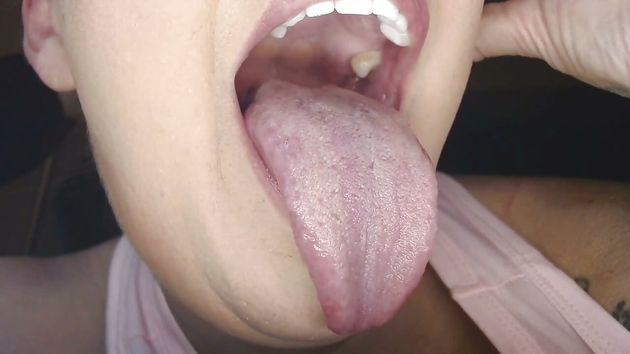 特寫口腔內部合集