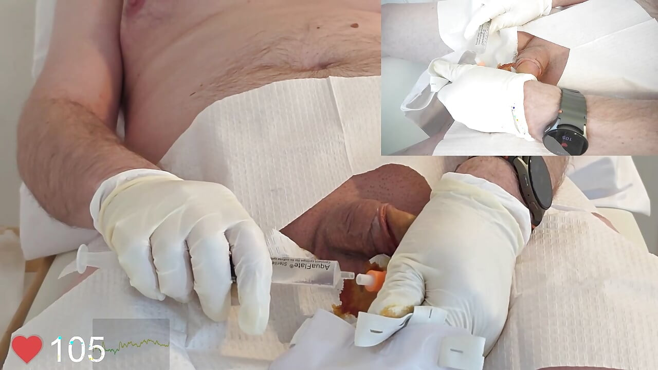 Close-Up insertion of a 16 French foley catheter