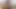 Lizzy Yum December 2023 locked up AGAIN Post Op Orgasm Pussy masturbation teasing