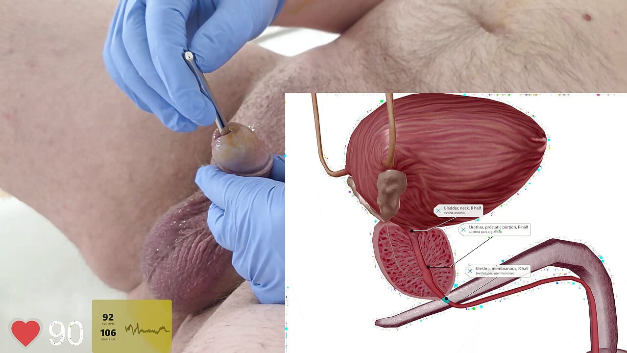 Second time trying urethral sounding and reviewing anatomy