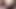 バビ・ニッチファック