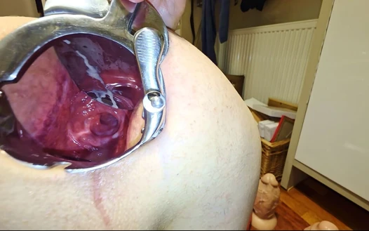 Aşırı anal speculum anal kanalımı açıyor!